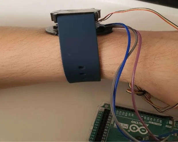 iLancet Autonomous Smart Bracelet worn on wrist